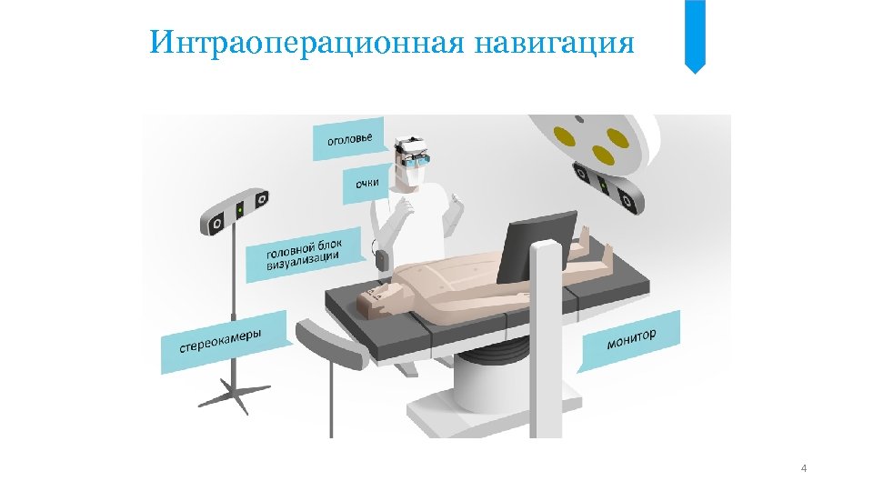 Интраоперационная навигация 4 
