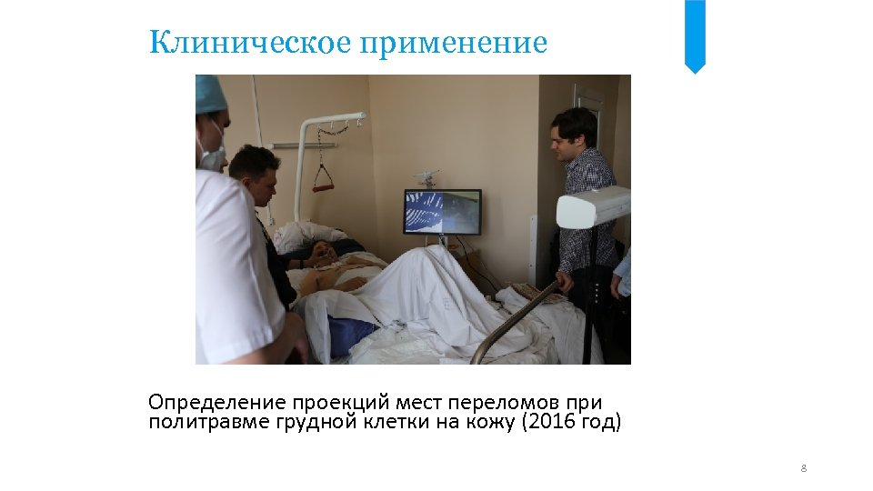 Клиническое применение Определение проекций мест переломов при политравме грудной клетки на кожу (2016 год)