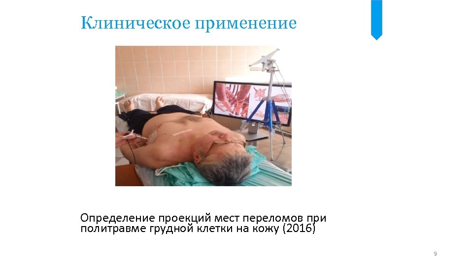 Клиническое применение Определение проекций мест переломов при политравме грудной клетки на кожу (2016) 9