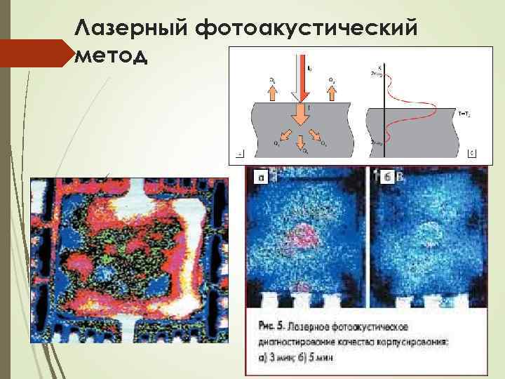 Лазерный фотоакустический метод 