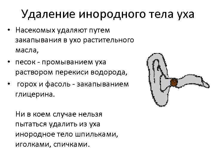 Удали путь. Методы удаления инородного тела из наружного уха. Последовательность действий при удалении насекомых из уха. Инородное тело уха удаляется. Удаление инородного тела из уха.