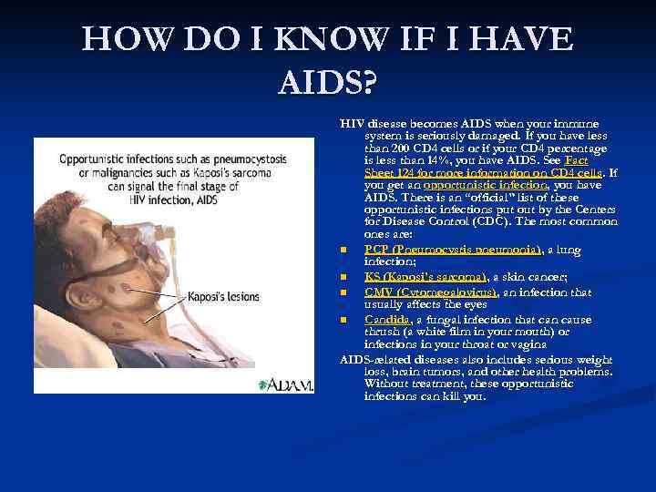 HOW DO I KNOW IF I HAVE AIDS? HIV disease becomes AIDS when your
