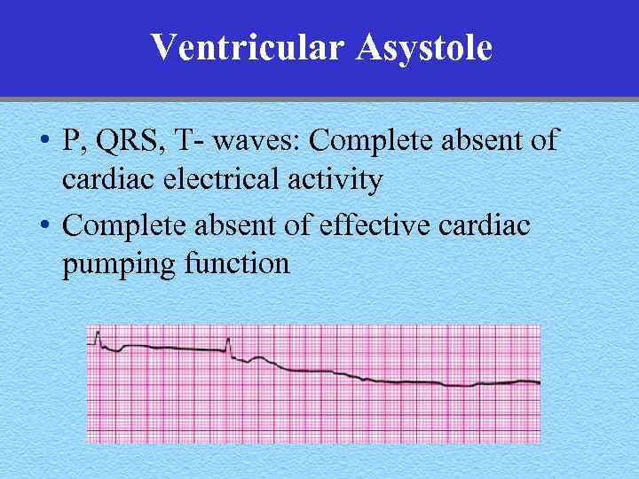 Ventricular Asystole • P, QRS, T- waves: Complete absent of cardiac electrical activity •