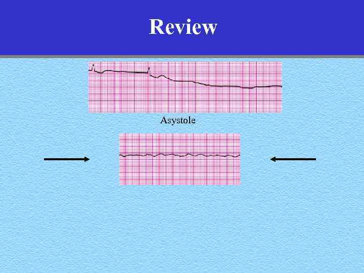 Review Asystole 
