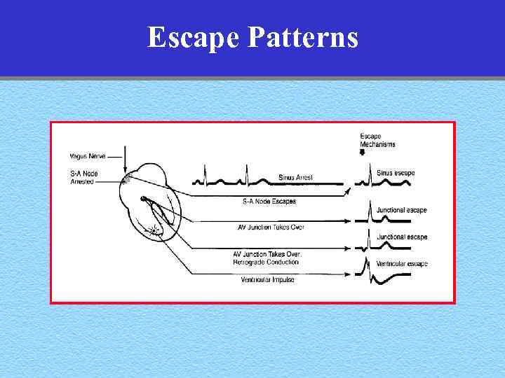 Escape Patterns 