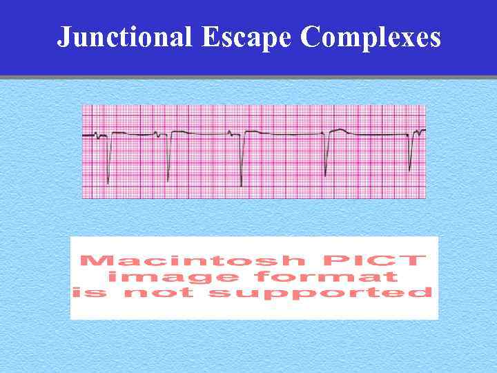 Junctional Escape Complexes 