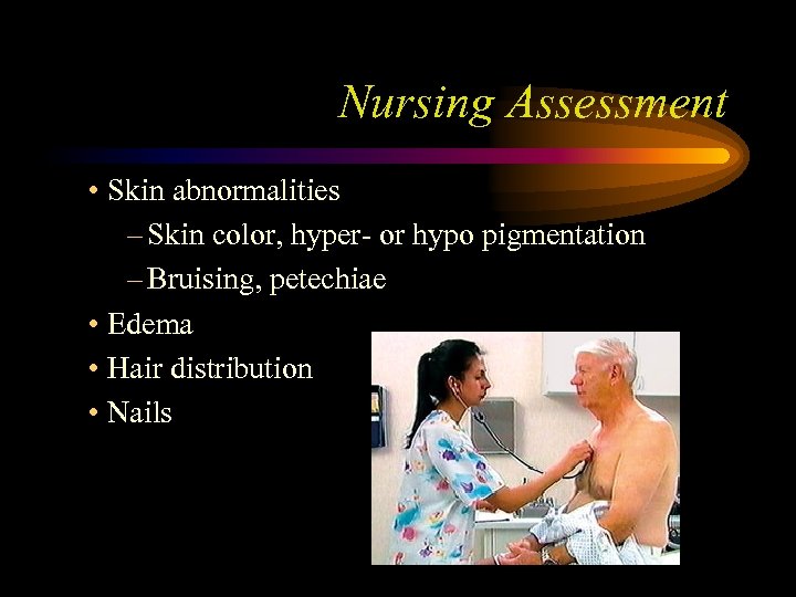 Nursing Assessment • Skin abnormalities – Skin color, hyper- or hypo pigmentation – Bruising,