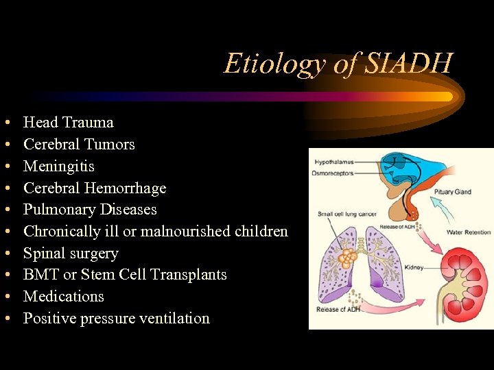 Etiology of SIADH • • • Head Trauma Cerebral Tumors Meningitis Cerebral Hemorrhage Pulmonary