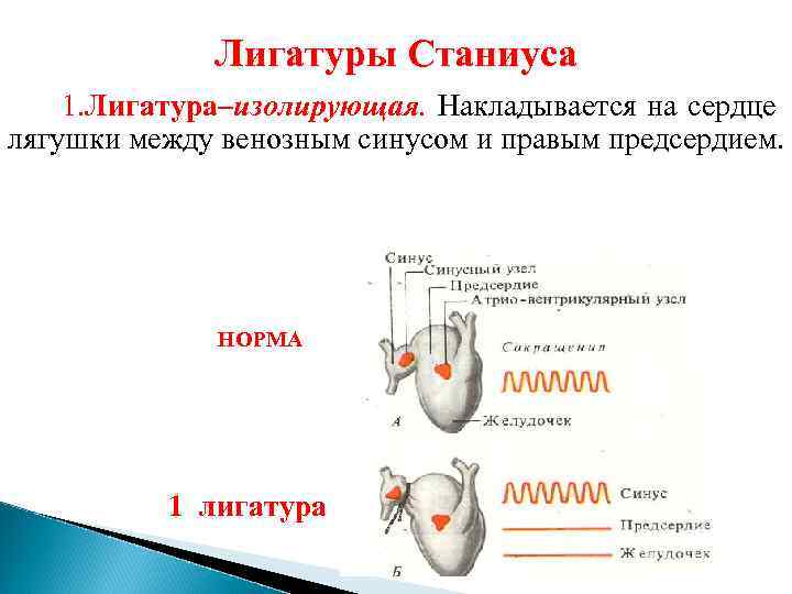 Лигатуры Станиуса 1. Лигатура–изолирующая. Накладывается на сердце лягушки между венозным синусом и правым предсердием.