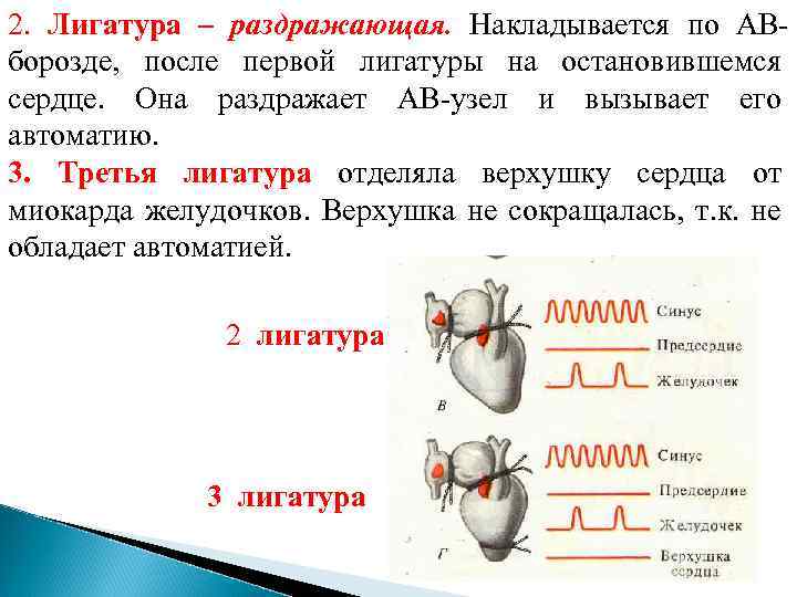 2. Лигатура – раздражающая. Накладывается по АВборозде, после первой лигатуры на остановившемся сердце. Она