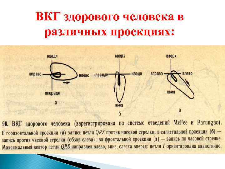 ВКГ здорового человека в различных проекциях: 