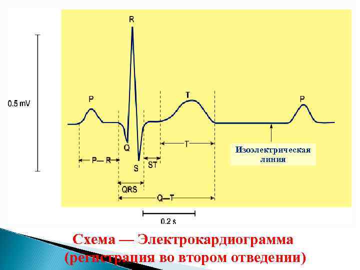 Изоэлектрическая линия Схема — Электрокардиограмма (регистрация во втором отведении) 