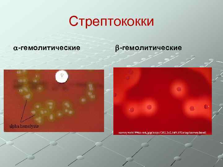 Стрептококки -гемолитические 