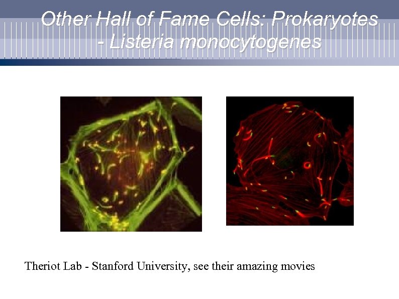 Other Hall of Fame Cells: Prokaryotes - Listeria monocytogenes Theriot Lab - Stanford University,