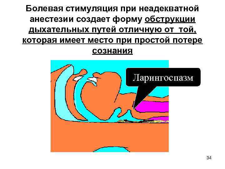 Болевая стимуляция при неадекватной анестезии создает форму обструкции дыхательных путей отличную от той, которая