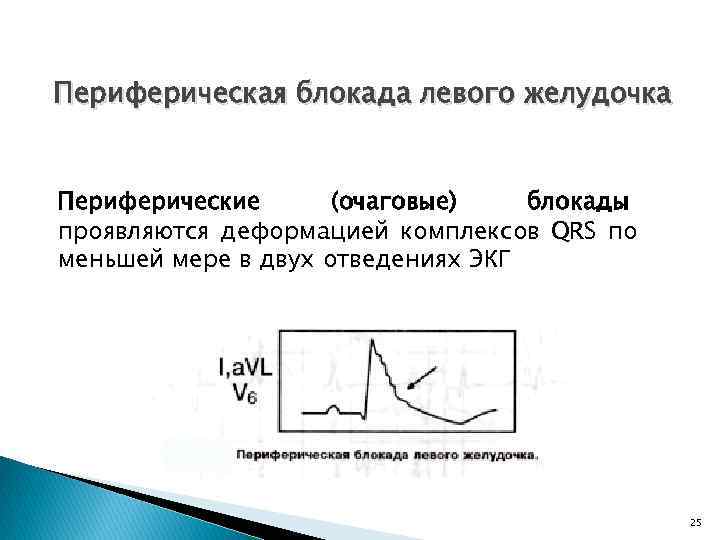 Нарушения проводимости презентация