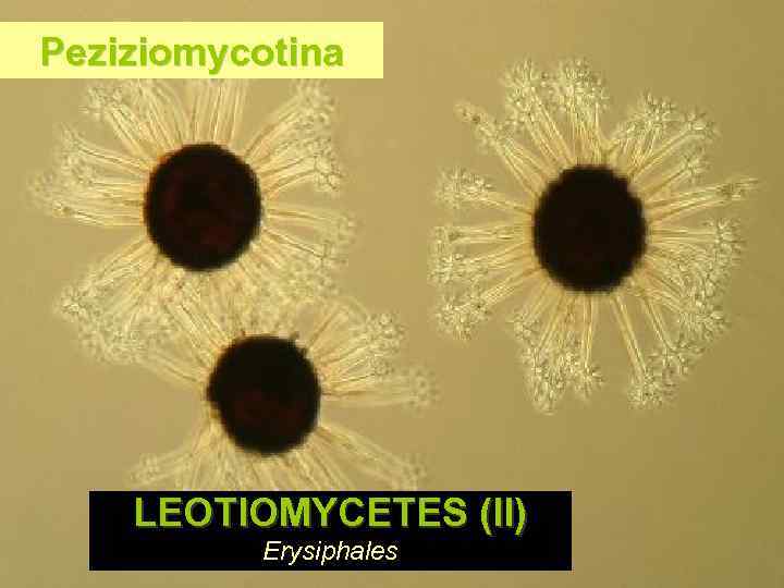 Peziziomycotina LEOTIOMYCETES (II) Erysiphales 