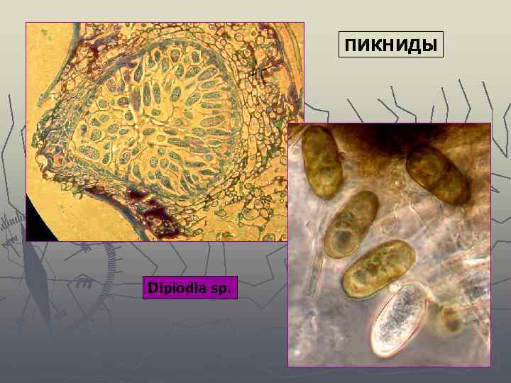 ПИКНИДЫ Diplodia sp. 