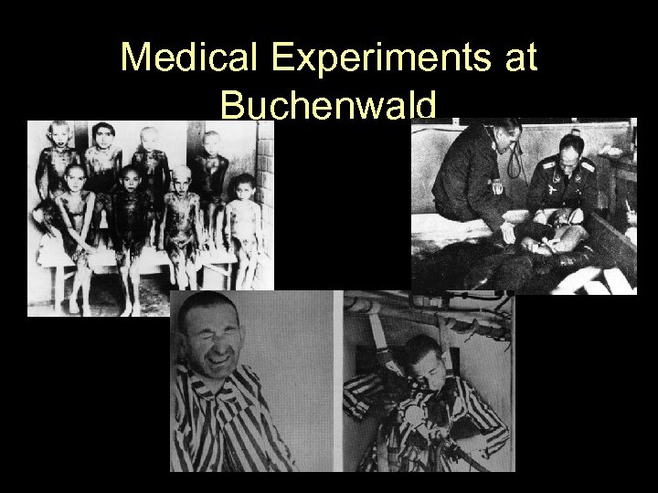 Medical Experiments at Buchenwald 