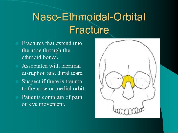 Naso-Ethmoidal-Orbital Fractures that extend into the nose through the ethmoid bones. l Associated with