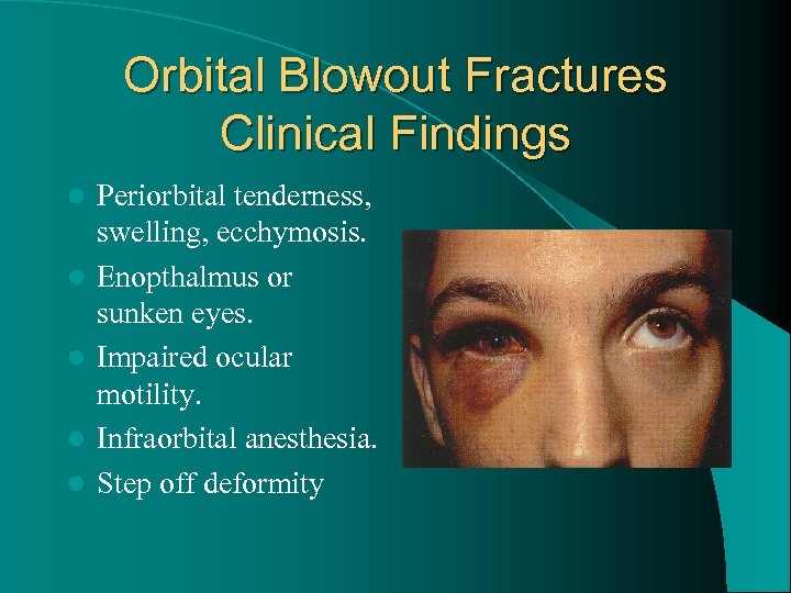 Orbital Blowout Fractures Clinical Findings l l l Periorbital tenderness, swelling, ecchymosis. Enopthalmus or