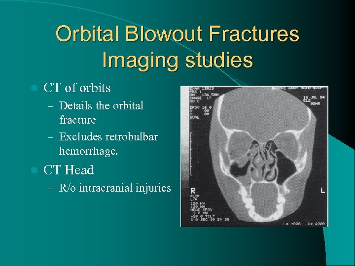 Orbital Blowout Fractures Imaging studies l CT of orbits – Details the orbital fracture