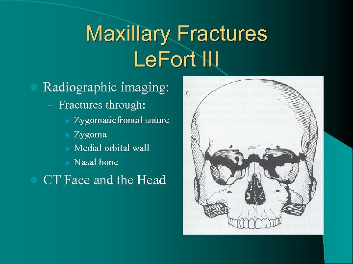 Maxillary Fractures Le. Fort III l Radiographic imaging: – Fractures through: l l l