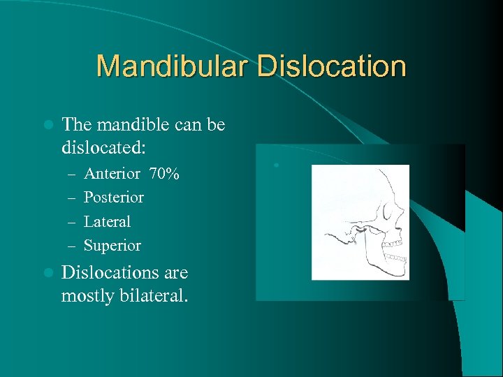 Mandibular Dislocation l The mandible can be dislocated: – Anterior 70% – Posterior –