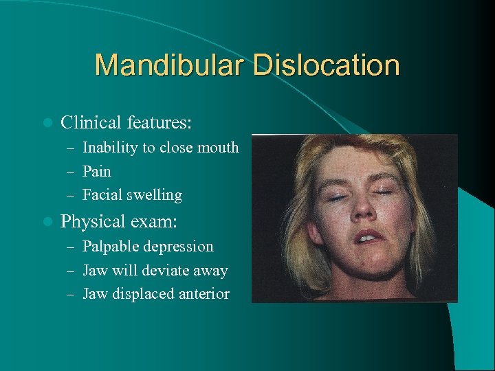 Mandibular Dislocation l Clinical features: – Inability to close mouth – Pain – Facial