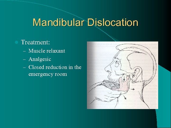 Mandibular Dislocation l Treatment: – Muscle relaxant – Analgesic – Closed reduction in the