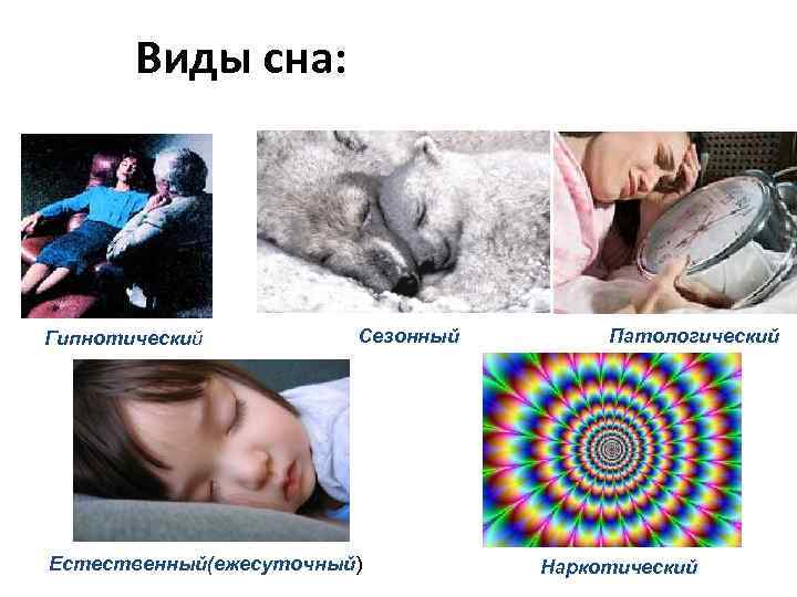 Виды сна: Гипнотический Сезонный Естественный(ежесуточный) Патологический Наркотический 