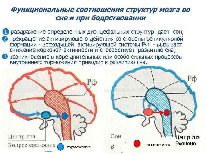 Диэнцефальная дисфункция головного мозга