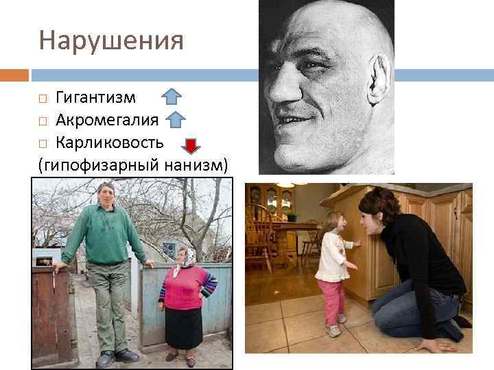 Гипофизарный гигантизм презентация