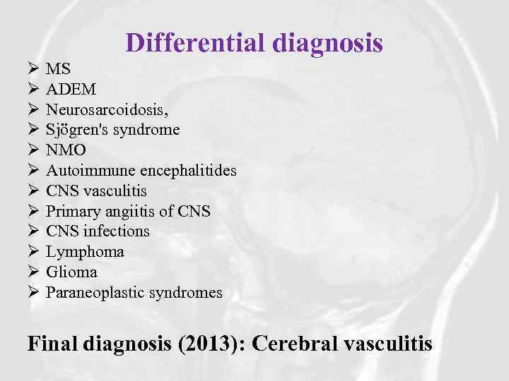 Differential diagnosis Ø Ø Ø MS ADEM Neurosarcoidosis, Sjögren's syndrome NMO Autoimmune encephalitides CNS