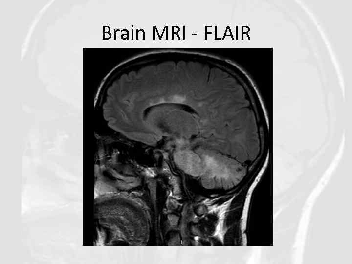 Brain MRI - FLAIR 