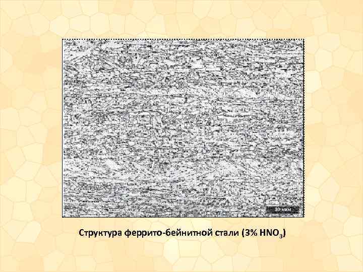 Структура феррито-бейнитной стали (3% HNO 3) 