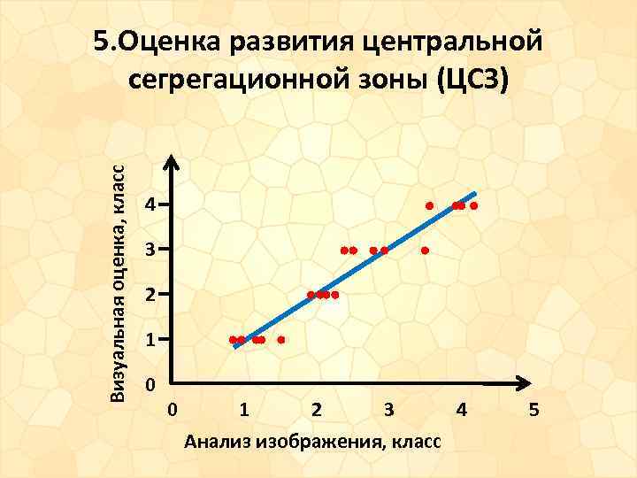 Визуальная оценка, класс 5. Оценка развития центральной сегрегационной зоны (ЦСЗ) 4 3 2 1