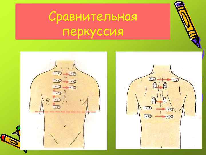 Схема сравнительной перкуссии легких