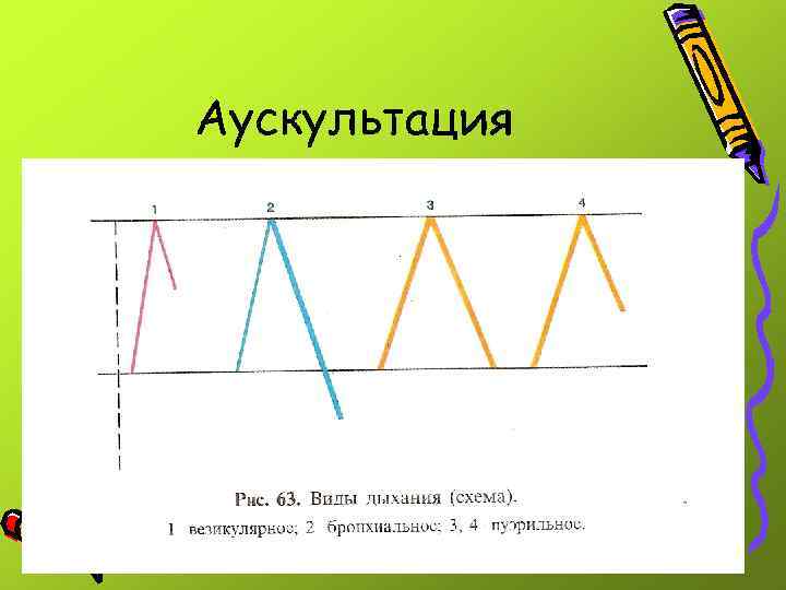 Аускультация 