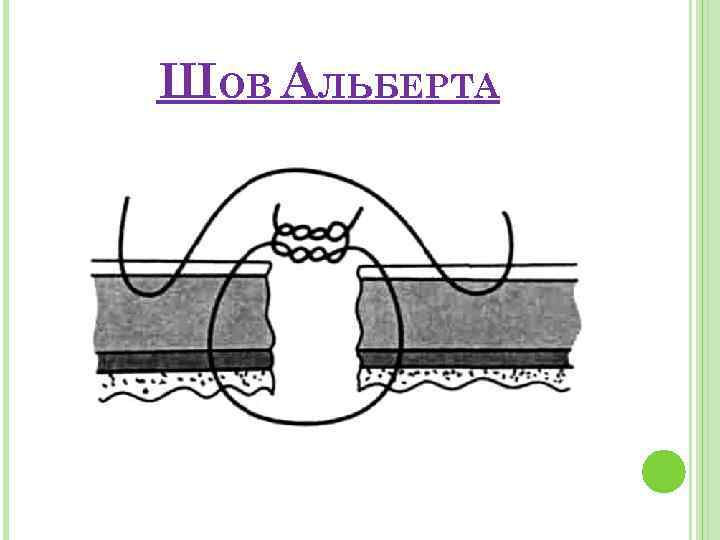 ШОВ АЛЬБЕРТА 