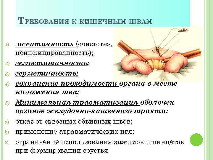 ТРЕБОВАНИЯ К КИШЕЧНЫМ ШВАМ 1) 2) 3) 4) 5) a) b) c) асептичность (