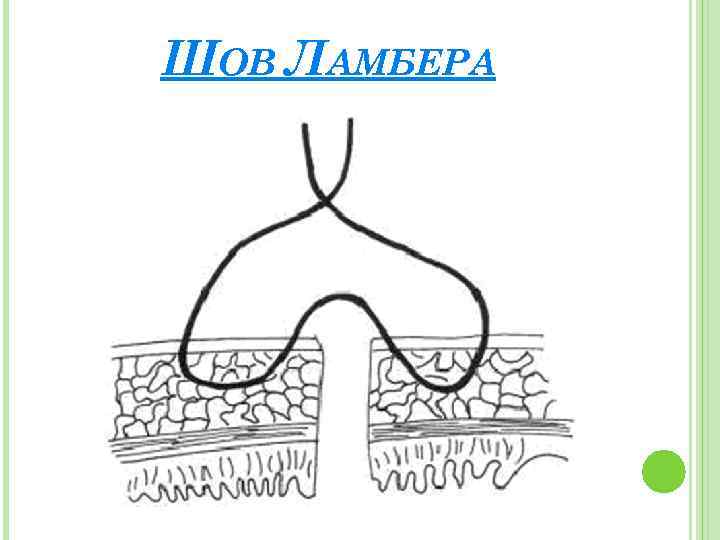 ШОВ ЛАМБЕРА 