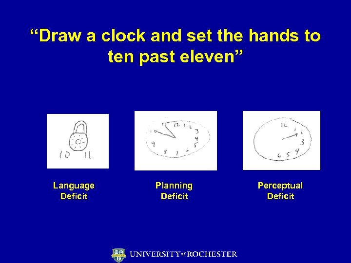 “Draw a clock and set the hands to ten past eleven” Language Deficit Planning