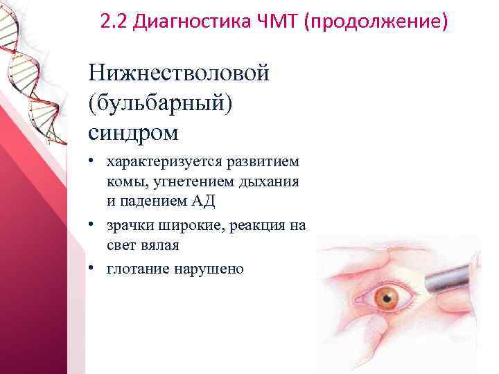 2. 2 Диагностика ЧМТ (продолжение) Нижнестволовой (бульбарный) синдром • характеризуется развитием комы, угнетением дыхания