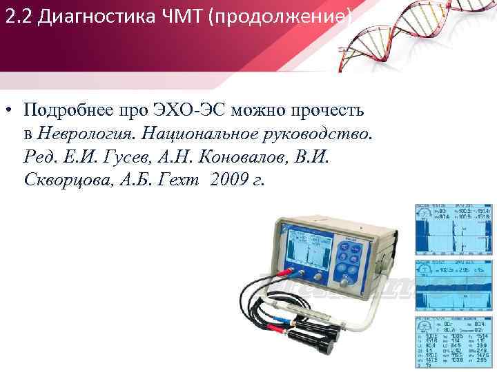 2. 2 Диагностика ЧМТ (продолжение) • Подробнее про ЭХО ЭС можно прочесть в Неврология.