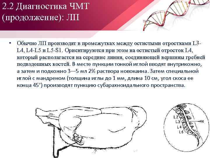 2. 2 Диагностика ЧМТ (продолжение): ЛП • Обычно ЛП производят в промежутках между остистыми