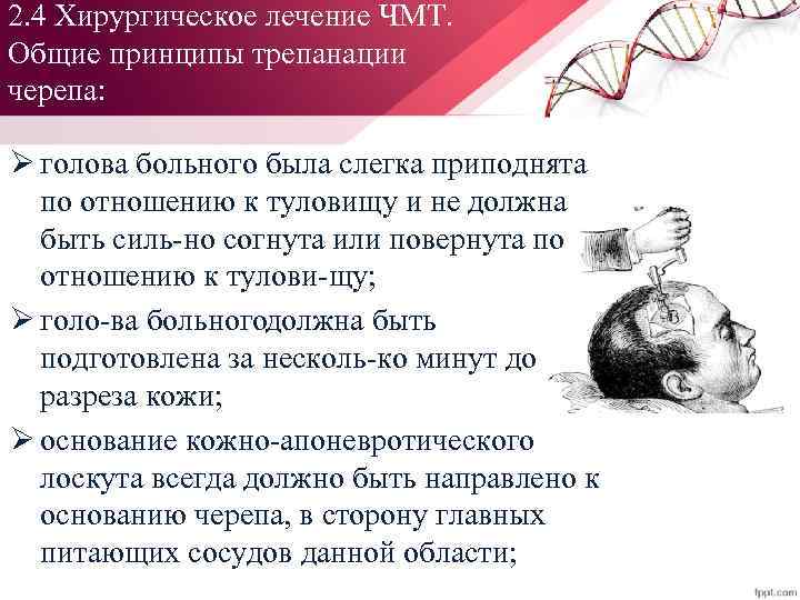 2. 4 Хирургическое лечение ЧМТ. Общие принципы трепанации черепа: Ø голова больного была слегка