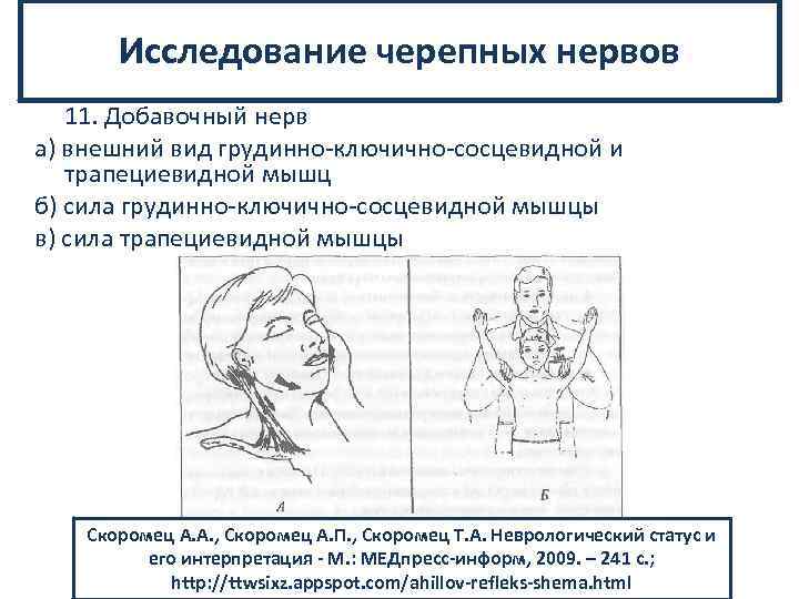 Исследование черепных нервов 11. Добавочный нерв а) внешний вид грудинно ключично сосцевидной и трапециевидной