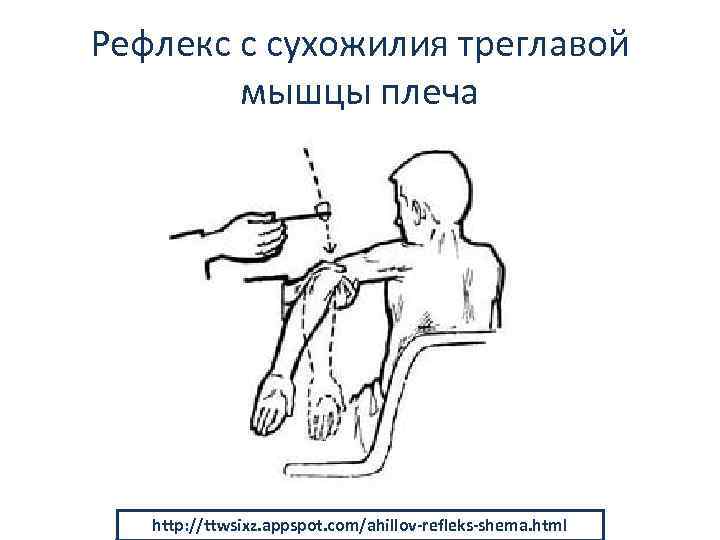 Рефлекс с сухожилия треглавой мышцы плеча http: //ttwsixz. appspot. com/ahillov-refleks-shema. html 