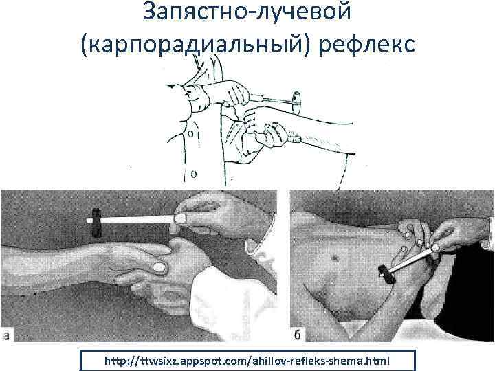 Запястно лучевой (карпорадиальный) рефлекс http: //ttwsixz. appspot. com/ahillov-refleks-shema. html 